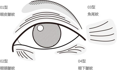 Diagram of eye wrinkles illustration