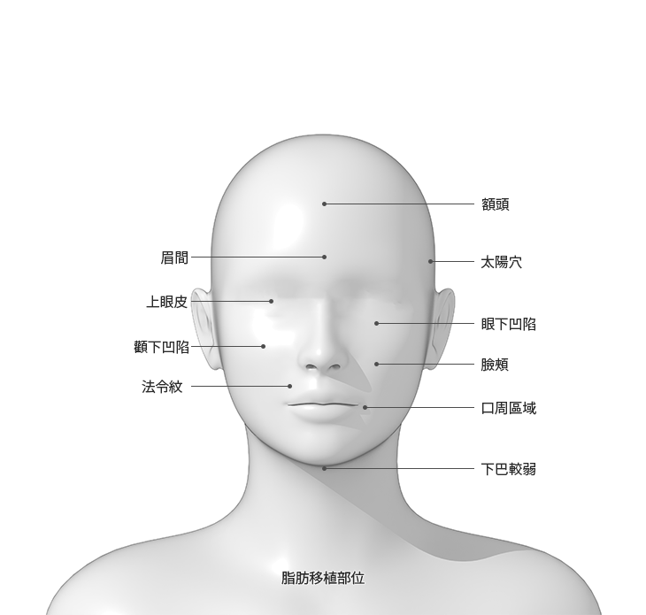 Diagram of facial areas labeled in Chinese.