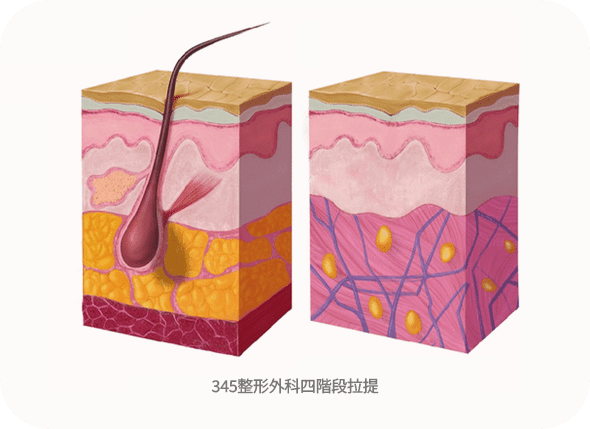 Hair follicle and skin layer diagram