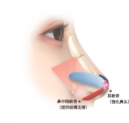 鼻中隔和耳軟骨構造示意圖