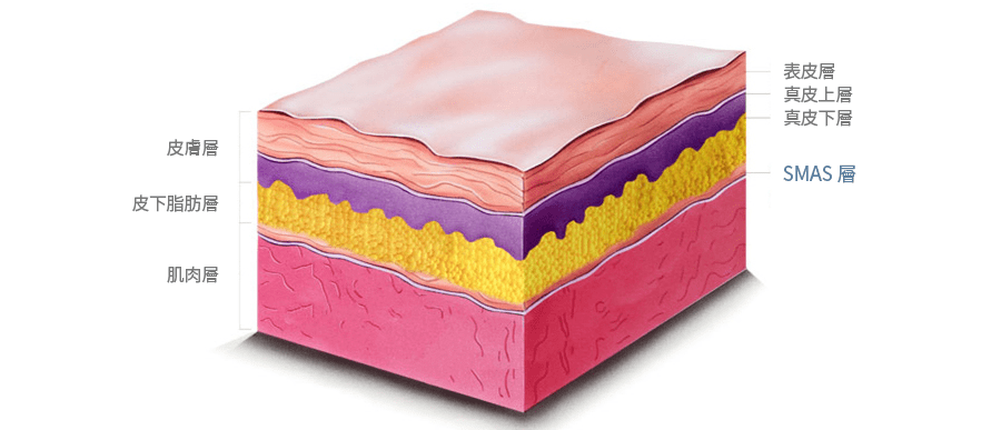 Illustration of skin layers and SMAS structure.