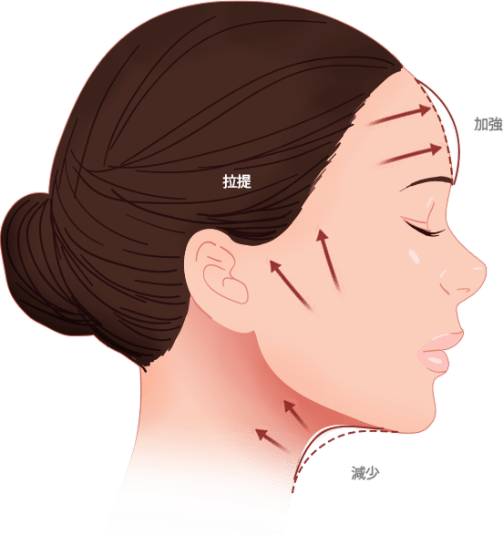 Facial massage direction illustration for skin tightening.
