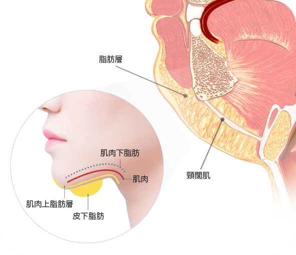 下巴脂肪層和肌肉結構剖面圖